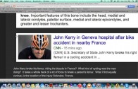 John Kerry’s Broken Thighbone in France- More Shenanigans from Skull and Bones Alumni?